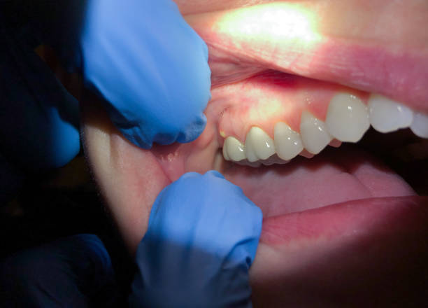 Best Emergency Gum Pain Relief  in Fairdale, PA